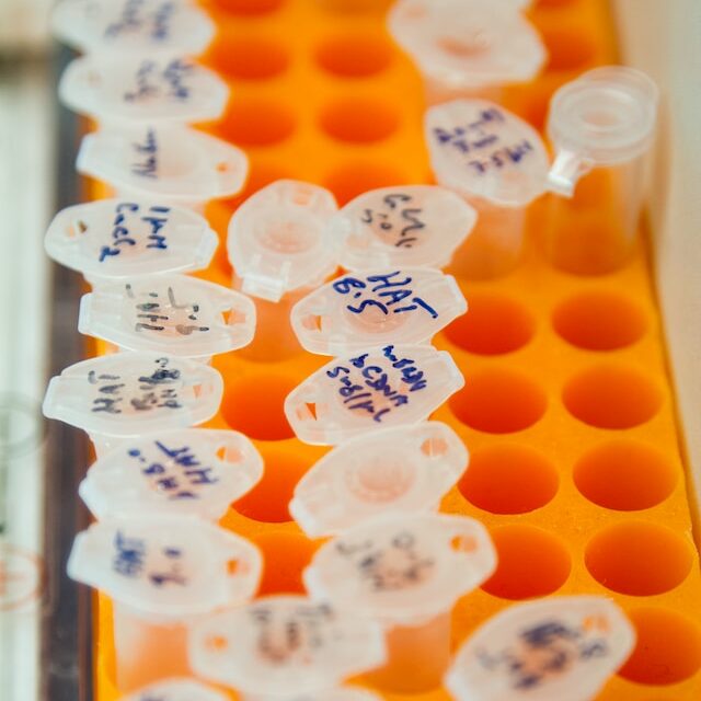 national-cancer-institute-jeT_DE3esSI-unsplash
